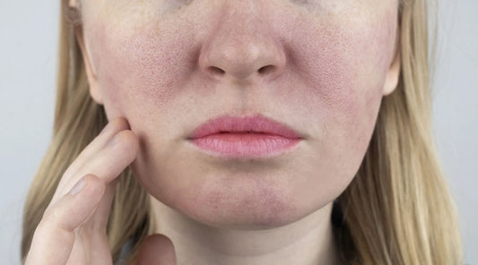 Effective Solutions for Open Pores on Face