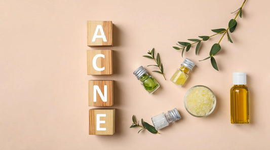 Home Remedies for Acne: Natural Solutions for Clearer Skin