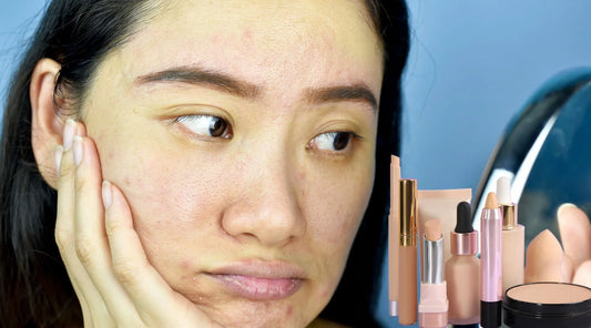 The Best Foundation for Acne Prone Skin: A Comprehensive Guide